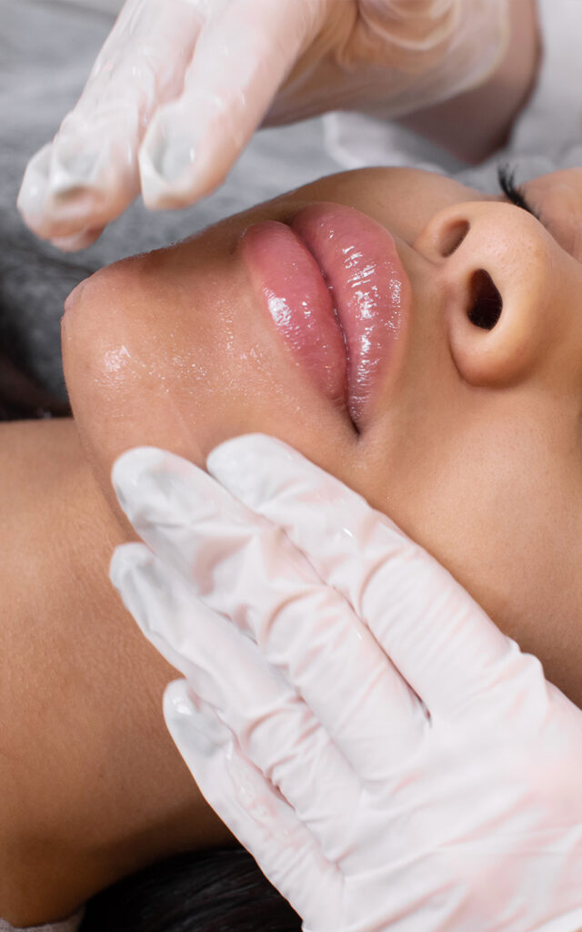 AHA Micro Peel5